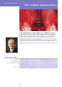 Geistlich - Indication sheets PIR3 - Periimplant Augmentation