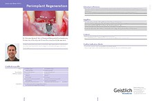 Geistlich - Indication sheets