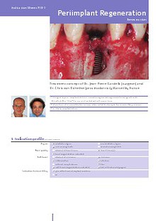 Geistlich - Indication sheets