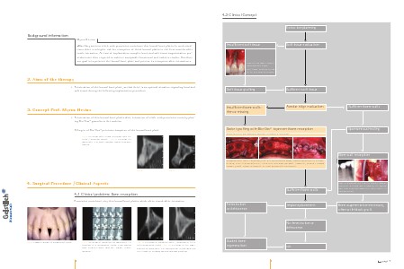 Geistlich - Indication sheets E2 - Extraction Sockets