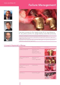 Geistlich - Indication sheets X3 - Failure Management