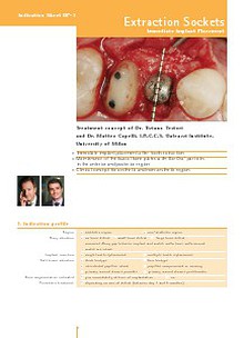 Geistlich - Indication sheets