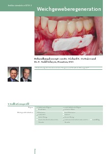 STR2 - Soft-Tissue Regeneration