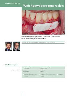 Geistlich - Indication sheets