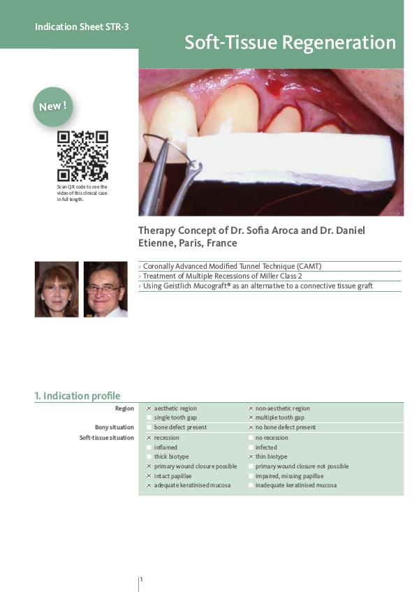 Geistlich - Indication sheets STR-3 Soft-tissue regeneration