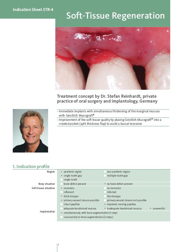 Geistlich - Indication sheets STR-4 Soft-tissue Regeneration