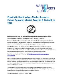 Market Research Reprots- Worldwide