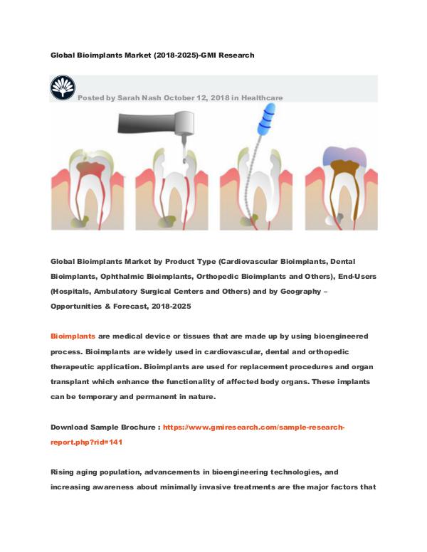 Global Bioimplants Market (2018-2025)-GMI Research Global Bioimplants Market (2018-2025)-GMI Research