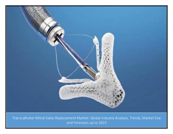 IGR Transcatheter Mitral Valve Replacement Market