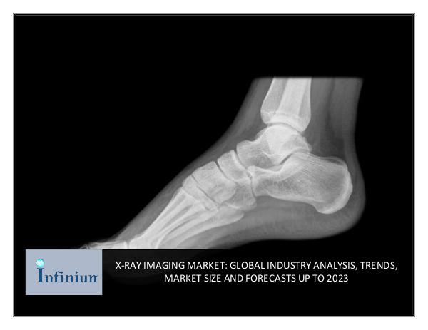 X-RAY IMAGING MARKET