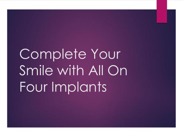 Complete Your Smile with All On Four Implants