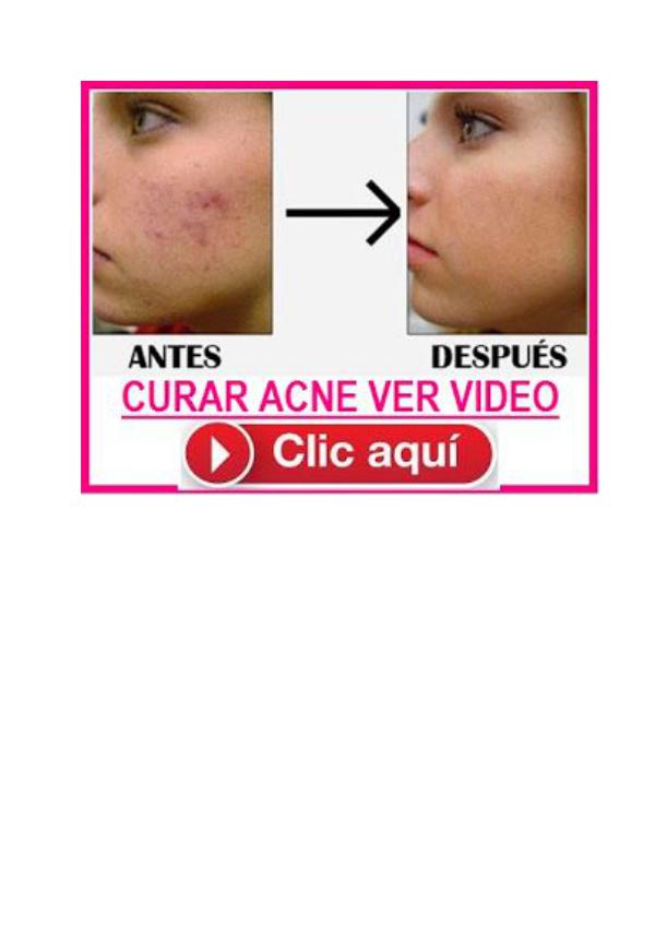 Acne No Mas (PDF) El Libro de Mike Walden  ¿Funciona?