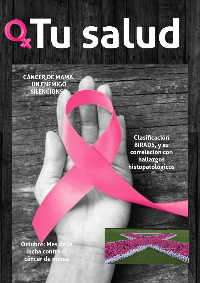 Tu salud Cáncer de mama.