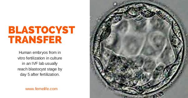 Blastocyst Transfer blastocysttransfer