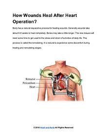 Heart and Aorta