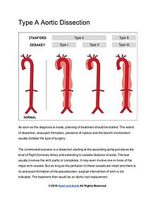 Heart and Aorta