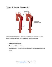 Heart and Aorta