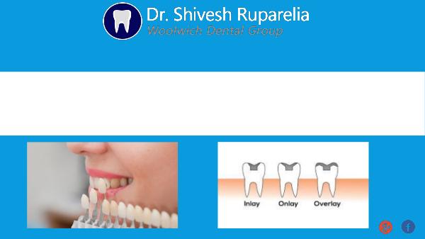 Dental Veneers vs. Crowns: Differences between the two? Difference Between Dental Veneers and Crowns