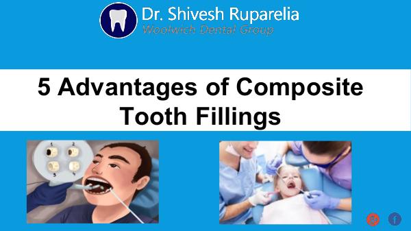 5 Benefits of Composite Tooth Fillings 5 Advantages of Composite Tooth Fillings