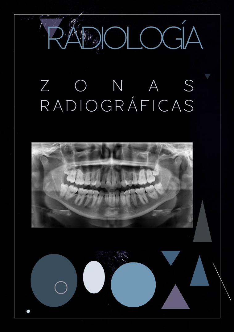 ZONAS RADIOGRÁFICAS