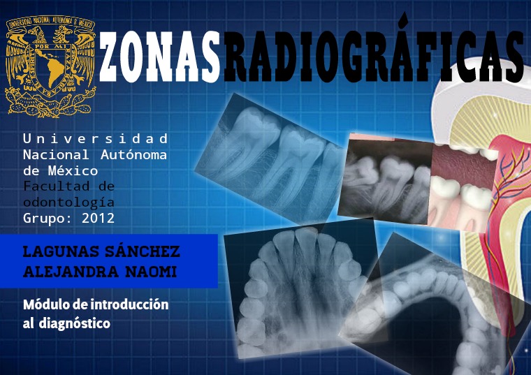 Zonas radiográficas Zonas radiográficas