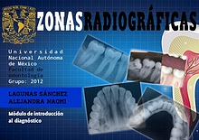 Zonas radiográficas