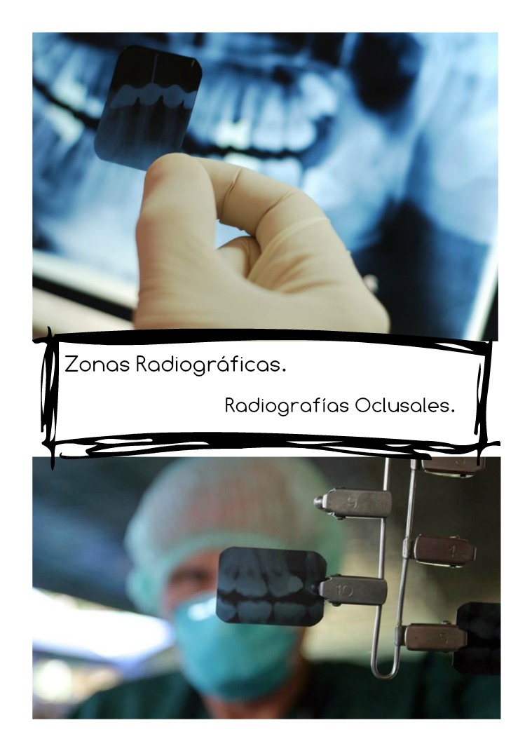 zonas radiográficas 1