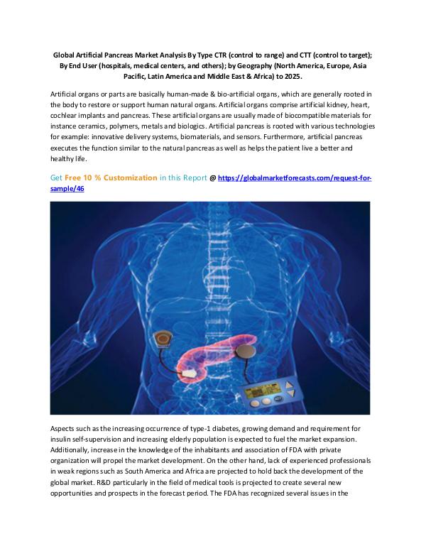 Global Artificial Pancreas Market Analysis By Type