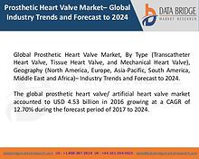 Market Research on Global Microsurgery Market – Industry Trends 2018