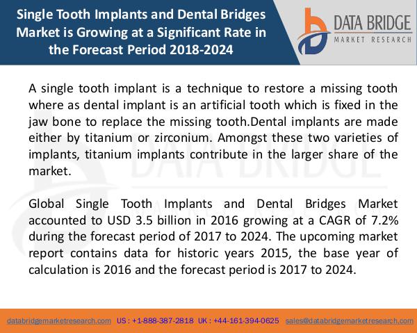 Global Single Tooth Implants and Dental Bridges Ma